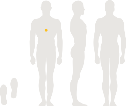 BALANCE Cell - Placement